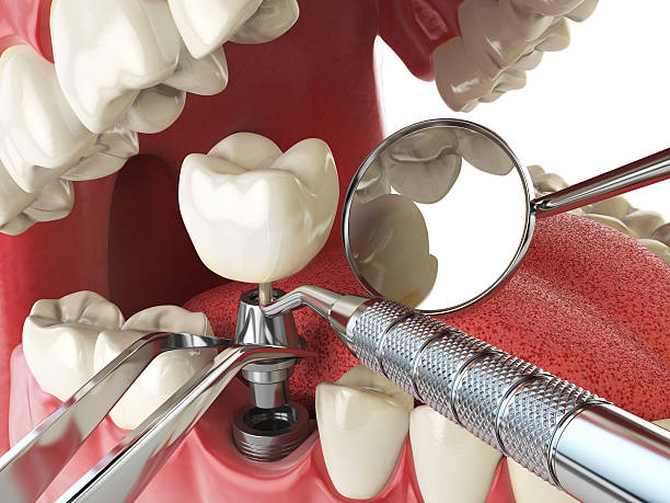 Best Emergency Dental Care for Trauma or Injury in Cypress Gardens, FL